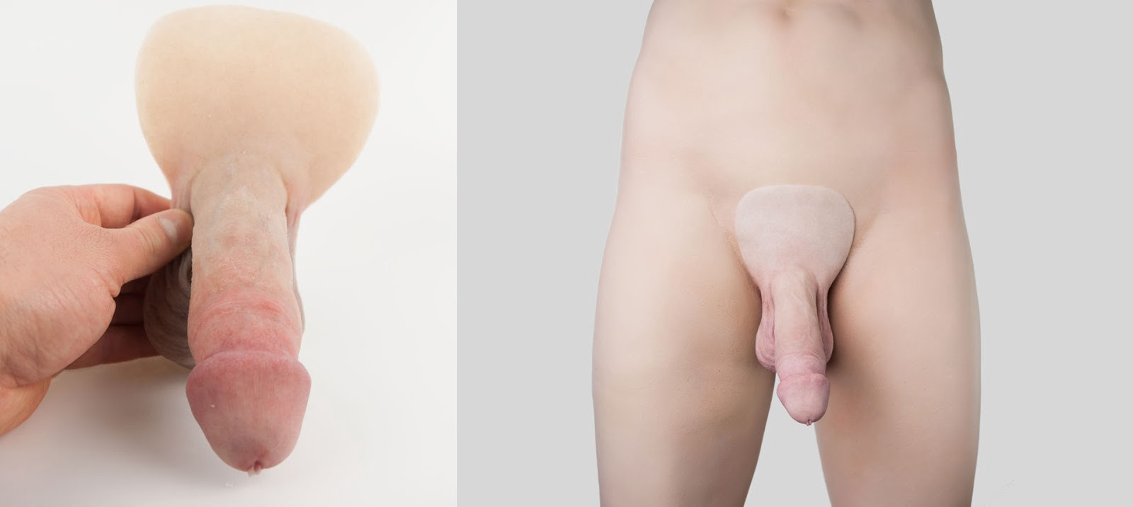 FTM penis prosthetic attached to the boddy