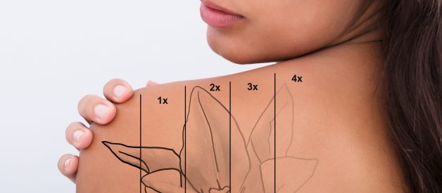 Demystifying the Laser Tattoo Removal Process