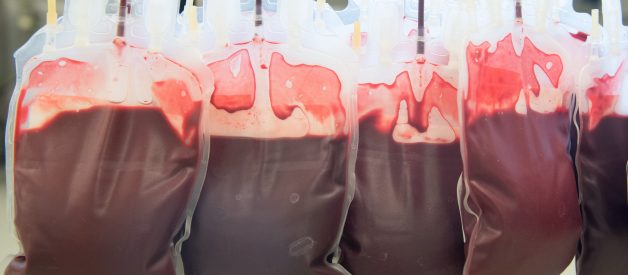 EXCLUSIVE: Ambrosia, the Young Blood Transfusion Startup, Is Quietly Back in Business