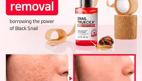 Your Snail Mucin FAQs, Answered!
